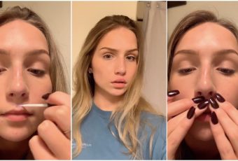 Meanwhile on TikTok, people are super-glueing their lips